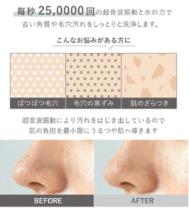 1台13役 美顔器 NITENA ニテナ [LOABI／ロアビ公式]｜美容 美肌ケア スキンケア [0621]