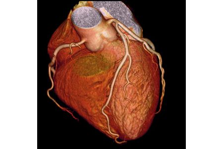 心臓ドッグ 冠動脈CTコース [0277]