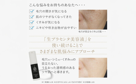 【ロゼべ】生プラセンタ 美容液 |京都 コスメ 美容液 人気 おすすめ