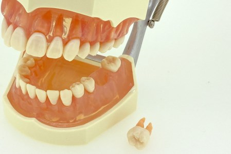 歯の模型 歯磨き指導用 実物大モデル（歯着脱可）《歯 模型 歯列模型 ...