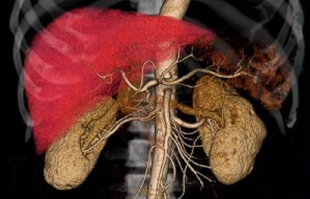 IGTクリニック 特殊がん検診 男性安心セット