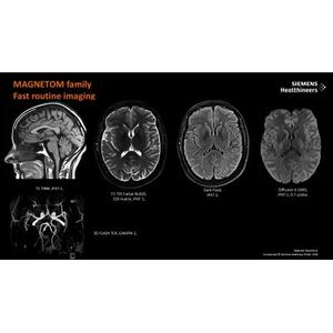 【健診】国循AI脳ドック(国立循環器病研究センター)【1620607】