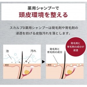 スカルプD　薬用スカルプシャンプー　オイリー [脂性肌用]|シャンプー メンズ 薬用 ヘアケア_アンファーシャンプー 育毛シャンプー 薬用シャンプー_【1531755】