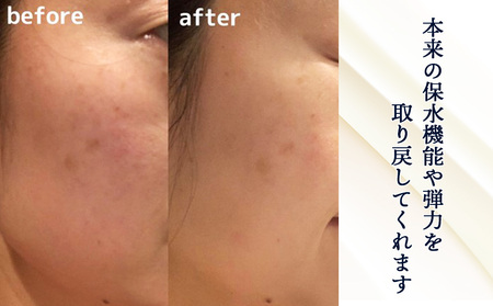 【定期便・全3回】北海道白老産 生プラセンタ美容液 ～アヨロのピリカ～