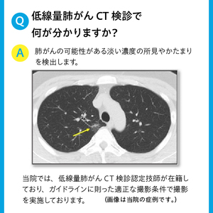 低線量肺がんCT検診利用券 [BM002]