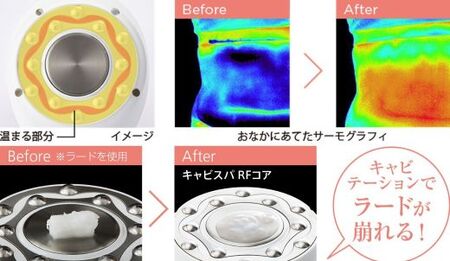 ヤーマン プレミアムセット　美容器 美顔器
