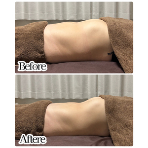 究極の腸もみ（YOLO式腸もみ×赤岩式）　90分3回コース　【650P8401】