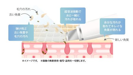 【ギフト対応】 美ルル アクアルファクラシック（ウォーターピーリング美顔器）ピンク