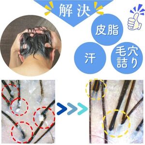 エミュールファインバブルシャワー(ブロンズ)と塩素除去カートリッジ1個セット【1619325】