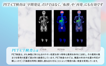 人間ドック PET-CTスタンダードコース チケット | がん検査
