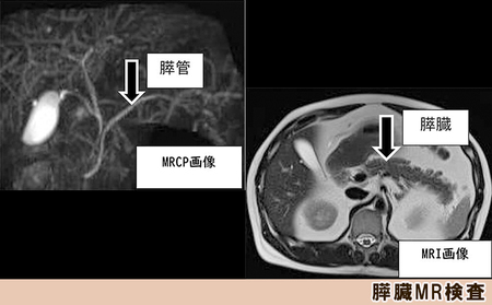 【亀田クリニック人間ドック】プレミアムVIP Ｂ（膵臓）コース　１名様（１泊２日）　[0960-0001]