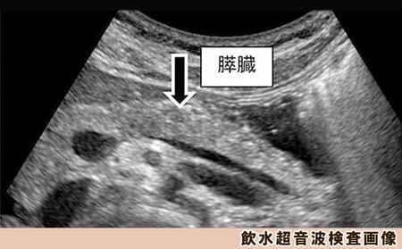 【亀田クリニック人間ドック】プレミアムVIP Ｂ（膵臓）コース　１名様（１泊２日）　[0960-0001]