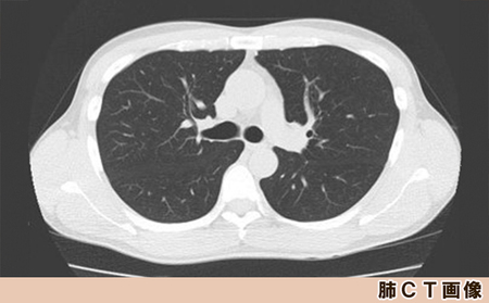 【亀田クリニック人間ドック】アドバンスト１（大腸）コース　１名様（１泊２日）　[0660-0002]