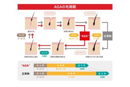 測定 AGA 薄毛リスク 髪の毛数本でわかる！【毛髪ホルモン量測定キット（DHT）】