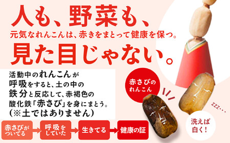 レンコン 3kg 金澤美人れんこん 蓮根 野菜 根菜