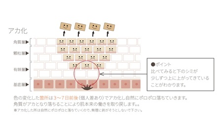 リアージュ（シミケア）30分コース 5回券 フェイシャルコース クレンジング 角質ケア マスク ヘッドマッサージ 低周波パルス チケット 5回分 セット プライベートサロン Bodycare Salon MYSA 山梨県 北杜市