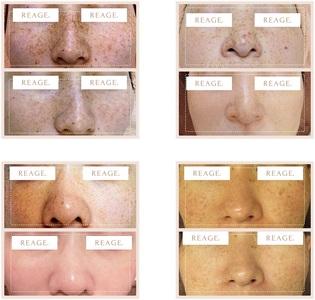 リアージュ(シミケア)30分コース 年間フリーパス フェイシャルコース 最大26回 クレンジング 角質ケア マスク ヘッドマッサージ 低周波パルス 年パス チケット プライベートサロン Bodycare Salon MYSA 山梨県 北杜市