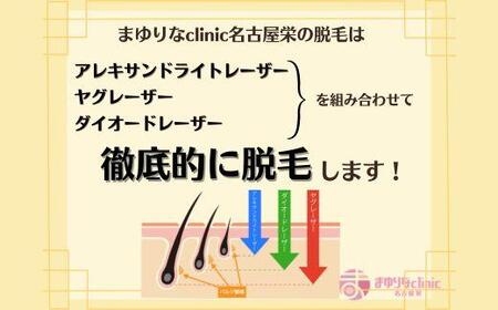 【男性医療脱毛】VIO 5回コース