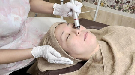 美容医療 脱毛・美肌 選べる!施術100万円分【組み合わせ自由】まゆりなclinic名古屋栄