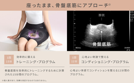 Perine Fit ペリネフィット